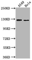 Western Blot Positive WB detected in: A549 whole cell lysate, Hela whole cell lysate All lanes: IGSF3 antibody at 1:2000 Secondary Goat polyclonal to rabbit IgG at 1/50000 dilution Predicted band size: 136, 138 kDa Observed band size: 125 kDa