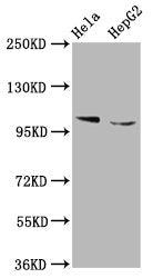 Western Blot Positive WB detected in: Hela whole cell lysate, HepG2 whole cell lysate All lanes: IKBKAP antibody at 5.3ug/ml Secondary Goat polyclonal to rabbit IgG at 1/50000 dilution Predicted band size: 151 kDa Observed band size: 151 kDa