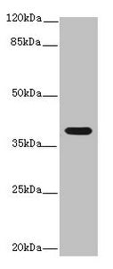 Western blot All lanes: Interleukin-12 subunit beta antibody at 14ug/ml + K562 whole cell lysate Secondary Goat polyclonal to rabbit IgG at 1/10000 dilution Predicted band size: 37 kDa Observed band size: 37 kDa