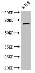 Western Blot Positive WB detected in: K562 whole cell lysate All lanes: IL12RB1 antibody at 3.5µg/ml Secondary Goat polyclonal to rabbit IgG at 1/50000 dilution Predicted band size: 74, 73, 43 kDa Observed band size: 74 kDa