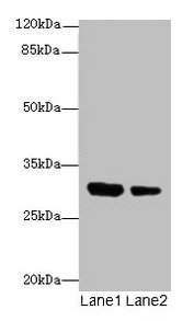 Western blot All lanes: IL1A antibody at 6µg/ml Lane 1: Jurkat whole cell lysate Lane 2: Human placenta tissue Secondary Goat polyclonal to rabbit IgG at 1/10000 dilution Predicted band size: 31 kDa Observed band size: 31 kDa