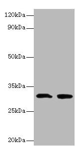 Western blot All lanes: IL1B antibody at 2µg/ml Lane 1: Recombinant Interleukin-1 beta protein 0.05µg Lane 2: Recombinant Interleukin-1 beta protein 0.5µg Secondary Goat polyclonal to rabbit IgG at 1/10000 dilution Predicted band size: 31 kDa Obse...