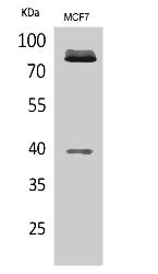 Western Blot analysis of MCF7 cells using CSB-PA011621ESR1HU. Secondary antibody(HRP* Goat Anti Rabbit IgG(H+L) ) was diluted at 1:20000