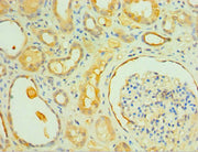 Immunohistochemistry of paraffin-embedded human kidney tissue using CSB-PA011621ESR2HU at dilution of 1:100
