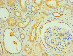 Immunohistochemistry of paraffin-embedded human kidney tissue using CSB-PA011621ESR2HU at dilution of 1:100