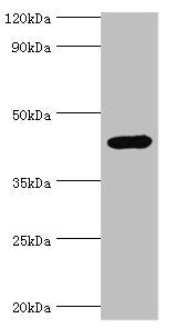 Western blot All lanes: Interleukin-1 receptor type 2 antibody at 3ug/ml + Mouse kidney tissue Secondary Goat polyclonal to rabbit IgG at 1/10000 dilution Predicted band size: 46, 34 kDa Observed band size: 46 kDa