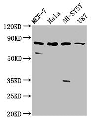 Western Blot Positive WB detected in: MCF-7 whole cell lysate, Hela whole cell lysate, SH-SY5Y whole cell lysate, U87 whole cell lysate All lanes: IL1RAPL1 antibody at 5.4µg/ml Secondary Goat polyclonal to rabbit IgG at 1/50000 dilution Predicted...