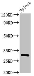 Western Blot Positive WB detected in: Rat spleen tissue All lanes: IL2RA antibody at 3.2ug/ml Secondary Goat polyclonal to rabbit IgG at 1/50000 dilution Predicted band size: 31 kDa Observed band size: 31 kDa