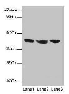 Western blot All lanes: IL2RG antibody at 12µg/ml Lane 1: Jurkat whole cell lysate Lane 2: K562 whole cell lysate Lane 3: HL60 whole cell lysate Secondary Goat polyclonal to rabbit IgG at 1/10000 dilution Predicted band size: 43, 21 kDa Observed b...