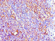 Immunohistochemistry of paraffin-embedded human tonsil tissue using CSB-PA011652ESR1HU at dilution of 1:100