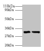 Western blot All lanes: IL-33 antibody at 2µg/ml Lane 1: Hela whole cell lysate Lane 2: Mouse lung tissue Secondary Goat polyclonal to rabbit IgG at 1/10000 dilution Predicted band size: 32 kDa Observed band size: 32 kDa