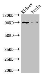 Western Blot Positive WB detected in: Mouse kidney tissue, Mouse brain tissue All lanes: IL4 antibody at 3ug/ml Secondary Goat polyclonal to rabbit IgG at 1/50000 dilution Predicted band size: 18, 16 kDa Observed band size: 90 kDa