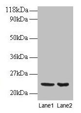Western blot All lanes: PRDX1 antibody at 2µg/ml Lane 1: EC109 whole cell lysate Lane 2: 293T whole cell lysate Secondary Goat polyclonal to rabbit IgG at 1/15000 dilution Predicted band size: 23 kDa Observed band size: 23 kDa