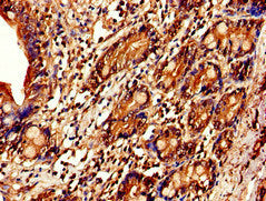Immunohistochemistry of paraffin-embedded human small intestine tissue using CSB-PA011670EA01HU at dilution of 1:100