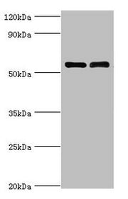 Western blot All lanes: IL7R antibody at 4µg/ml Lane 1: K562 whole cell lysate Lane 2: Jurkat whole cell lysate Secondary Goat polyclonal to rabbit IgG at 1/10000 dilution Predicted band size: 52, 35, 30, 29 kDa Observed band size: 52 kDa