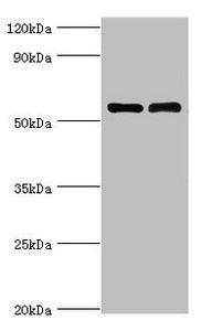 Western blot All lanes: IL7R antibody at 4µg/ml Lane 1: K562 whole cell lysate Lane 2: Jurkat whole cell lysate Secondary Goat polyclonal to rabbit IgG at 1/10000 dilution Predicted band size: 52, 35, 30, 29 kDa Observed band size: 52 kDa