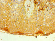 Immunohistochemistry of paraffin-embedded human skin tissue using CSB-PA011670ESR2HU at dilution of 1:100