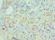 Immunohistochemistry of paraffin-embedded human kidney tissue using CSB-PA011675ESR2HU at dilution of 1:100