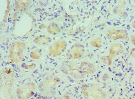 Immunohistochemistry of paraffin-embedded human kidney tissue using CSB-PA011675ESR2HU at dilution of 1:100