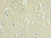 Immunohistochemistry of paraffin-embedded human brain tissue using CSB-PA011676ESR2HU at dilution of 1:100