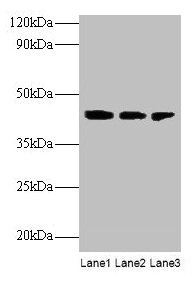 Western blot All lanes: ILKAP antibody at 2µg/ml Lane 1: Rat kidney tissue Lane 2: U251 whole cell lysate Lane 3: Mouse stomach tissue Secondary Goat polyclonal to rabbit IgG at 1/10000 dilution Predicted band size: 43 kDa Observed band size: 43 kDa