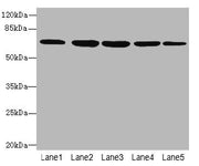Western blot All lanes: ILVBL antibody at 4µg/ml Lane 1: HepG2 whole cell lysate Lane 2: Hela whole cell lysate Lane 3: A549 whole cell lysate Lane 4: Jurkat whole cell lysate Lane 5: U87 whole cell lysate Secondary Goat polyclonal to rabbit IgG a...