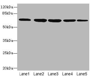 Western blot All lanes: ILVBL antibody at 4µg/ml Lane 1: HepG2 whole cell lysate Lane 2: Hela whole cell lysate Lane 3: A549 whole cell lysate Lane 4: Jurkat whole cell lysate Lane 5: U87 whole cell lysate Secondary Goat polyclonal to rabbit IgG a...