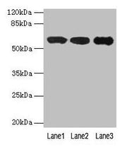 Western blot All lanes: IMPDH2 antibody at 12µg/ml Lane 1: Mouse heart tissue Lane 2: A549 whole cell lysate Lane 3: Hela whole cell lysate Secondary Goat polyclonal to rabbit IgG at 1/10000 dilution Predicted band size: 56 kDa Observed band size:...