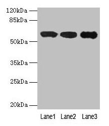 Western blot All lanes: IMPDH2 antibody at 12µg/ml Lane 1: Mouse heart tissue Lane 2: A549 whole cell lysate Lane 3: Hela whole cell lysate Secondary Goat polyclonal to rabbit IgG at 1/10000 dilution Predicted band size: 56 kDa Observed band size:...