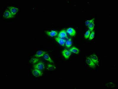 Immunofluorescence staining of Hela cells with CSB-PA011704LA01HU at 1:133, counter-stained with DAPI. The cells were fixed in 4% formaldehyde, permeabilized using 0.2% Triton X-100 and blocked in 10% normal Goat Serum. The cells were then incubat...