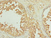 Immunohistochemistry of paraffin-embedded human testis tissue using CSB-PA011721ESR1HU at dilution of 1:100