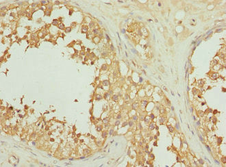 Immunohistochemistry of paraffin-embedded human testis tissue using CSB-PA011721ESR1HU at dilution of 1:100