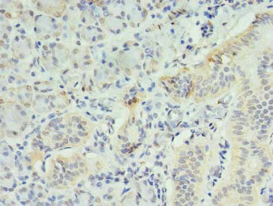 Immunohistochemistry of paraffin-embedded human pancreatic tissue using CSB-PA011729LA01HU at dilution of 1:100