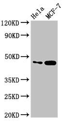 Western Blot Positive WB detected in: Hela whole cell lysate, MCF-7 whole cell lysate All lanes: INSIG1 antibody at 2.8µg/ml Secondary Goat polyclonal to rabbit IgG at 1/50000 dilution Predicted band size: 30, 18 kDa Observed band size: 46 kDa