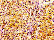 IHC image of CSB-PA011758EA01HU diluted at 1:100 and staining in paraffin-embedded human adrenal gland tissue performed on a Leica BondTM system. After dewaxing and hydration, antigen retrieval was mediated by high pressure in a citrate buffer (pH...