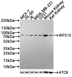 Western blot All lanes: INTS10 antibody at 4.35ug/ml Lane 1: Mouse kidney tissue Lane 2: Rat gonadal tissue Secondary Goat polyclonal to rabbit IgG at 1/10000 dilution Predicted band size: 82 kDa Observed band size: 82 kDa