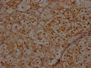 IHC image of CSB-PA011758LA01HU diluted at 1:300 and staining in paraffin-embedded human adrenal gland tissue performed on a Leica BondTM system. After dewaxing and hydration, antigen retrieval was mediated by high pressure in a citrate buffer (pH...