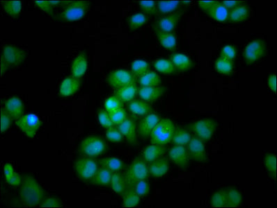Immunofluorescence staining of Hela cells with CSB-PA011761LA01HU at 1:66, counter-stained with DAPI. The cells were fixed in 4% formaldehyde, permeabilized using 0.2% Triton X-100 and blocked in 10% normal Goat Serum. The cells were then incubate...