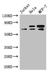 Western Blot Positive WB detected in: Jurkat whole cell lysate, Hela whole cell lysate, MCF-7 whole cell lysate All lanes: INTS9 antibody at 3.4ug/ml Secondary Goat polyclonal to rabbit IgG at 1/50000 dilution Predicted band size: 74, 72 kDa Obser...