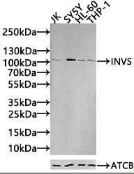 Western blot All lanes: INVS antibody IgG at 14ug/ml + K562 whole cell lysate Secondary Goat polyclonal to rabbit IgG at 1/10000 dilution Predicted band size: 118, 100, 11 kDa Observed band size: 118 kDa