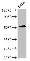 Western Blot Positive WB detected in: Hela whole cell lysate All lanes: IP6K1 antibody at 3.5ug/ml Secondary Goat polyclonal to rabbit IgG at 1/50000 dilution Predicted band size: 51, 32 kDa Observed band size: 51 kDa