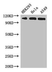 Western Blot Positive WB detected in: HEK293 whole cell lysate, Hela whole cell lysate, A549 whole cell lysate All lanes: IPO13 antibody at 3µg/ml Secondary Goat polyclonal to rabbit IgG at 1/50000 dilution Predicted band size: 109 kDa Observed ba...