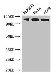 Western Blot Positive WB detected in: HEK293 whole cell lysate, Hela whole cell lysate, A549 whole cell lysate All lanes: IPO13 antibody at 3µg/ml Secondary Goat polyclonal to rabbit IgG at 1/50000 dilution Predicted band size: 109 kDa Observed ba...