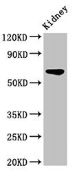Western Blot Positive WB detected in: Rat kidney tissue All lanes: IPP antibody at 3.2ug/ml Secondary Goat polyclonal to rabbit IgG at 1/50000 dilution Predicted band size: 66 kDa Observed band size: 66 kDa