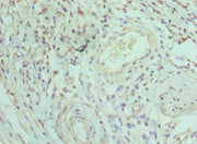 Immunohistochemistry of paraffin-embedded human epityphlon tissue using CSB-PA011811ESR1HU at dilution of 1:100