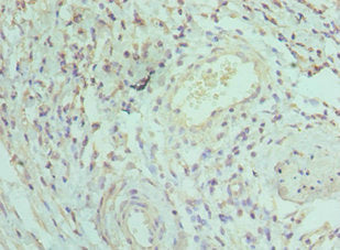 Immunohistochemistry of paraffin-embedded human epityphlon tissue using CSB-PA011811ESR1HU at dilution of 1:100