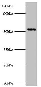 Western blot All lanes: Interleukin-1 receptor-associated kinase 4 antibody at 4ug/ml + Jurkat whole cell lysate Secondary Goat polyclonal to rabbit IgG at 1/10000 dilution Predicted band size: 52, 38 kDa Observed band size: 52 kDa