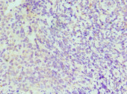 Immunohistochemistry of paraffin-embedded human tonsil tissue using CSB-PA011819ESR2HU at dilution of 1:100