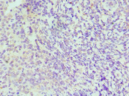 Immunohistochemistry of paraffin-embedded human tonsil tissue using CSB-PA011819ESR2HU at dilution of 1:100