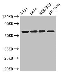 Western Blot Positive WB detected in: A549 whole cell lysate, Hela whole cell lysate, NIH/3T3 whole cell lysate, SH-SY5Y whole cell lysate All lanes: IRF5 antibody at 3ug/ml Secondary Goat polyclonal to rabbit IgG at 1/50000 dilution Predicted ban...
